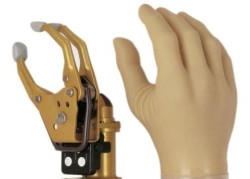 Hand prosthesis with external source of energy, including separation and partial separation of the hand PR0-23B1