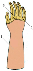 Cosmetic hand prosthesis, including partial and partial dislocation of the hand PR0-03