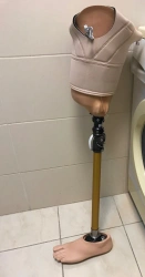 Modular hip prosthesis, including for congenital underdevelopment PH6-72.