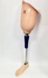 Modular hip prosthesis, including those with underdevelopment