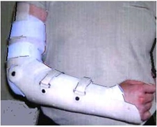 Wrist and elbow joint apparatus