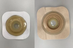 Rehabilitation device for stomical use in colostomies, ileostomies and urostomies: flat plate, convex plate.