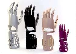 Active hand prosthesis