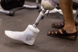 Modular tibia prosthesis, including underdevelopment, with microprocessor-controlled foot module