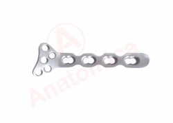 Plate for distal radius with angular stability.