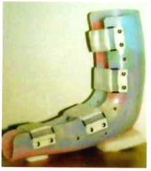 Elbow joint brace