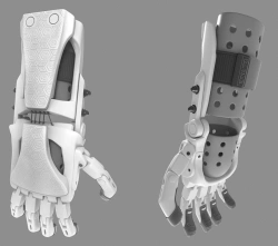 Active (traction) prosthesis of the hand, including for separation and partial separation of the hand