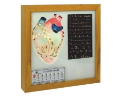 Electrical model of cardiac conduction system, 16012