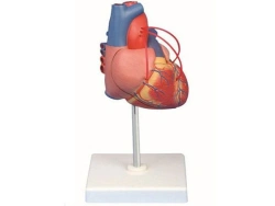 Bypass model, 16017