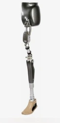 Modular microprocessor-controlled hip dislocation prosthesis