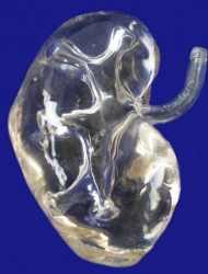 Transparent kidney model, 14008