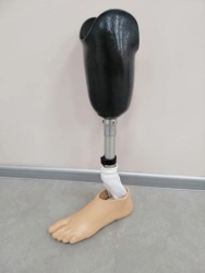 Modular tibial prostheses, including those with congenital malformations.