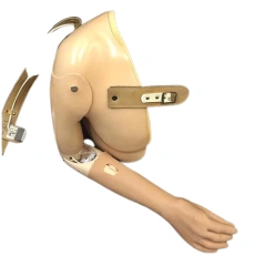 Prosthesis after shoulder dislocation with electromechanical actuator and contact control system PR8-MVE