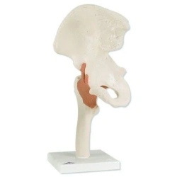 Life-size hip joint, SK2110