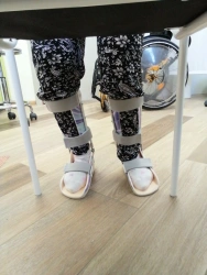 Ankle and Knee Orthopaedic Devices