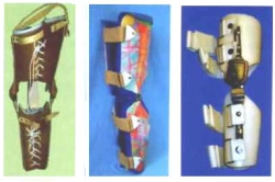 Knee joint apparatus