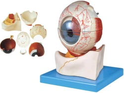 Enlarged eyeball model 17103