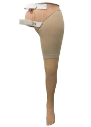 8-07-11 Modular hip replacement in case of hip dislocation.