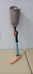 8.07-10 Modular hip prosthesis, including for congenital underdevelopment.