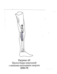 Modular hip prosthesis with external energy source PN6-78