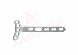 T-plate with angular stability with limited contact