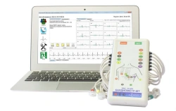 Complex for automated integral assessment of the functional state of the cardiovascular system KFS-01 "CARDIOMETR-MT"
