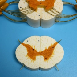 Model of enlarged spinal cord and spinal nerve branches, 18103