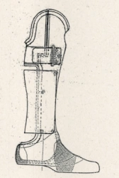 Foot prosthesis by Shopar (Lisfranc) PN0-06-02