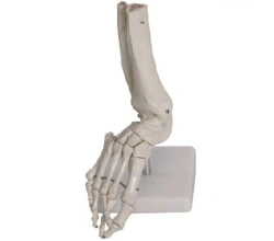 Bones of the foot, item 11201-6