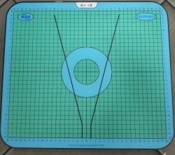 Stabilometric diagnostic and rehabilitation complex "Telereabos" (stabilographic system)