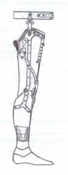 Non-modular hip prosthesis, including for congenital underdevelopment PN-NB