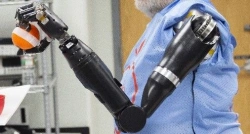 Prosthesis after shoulder dislocation with electromechanical drive and contact control system